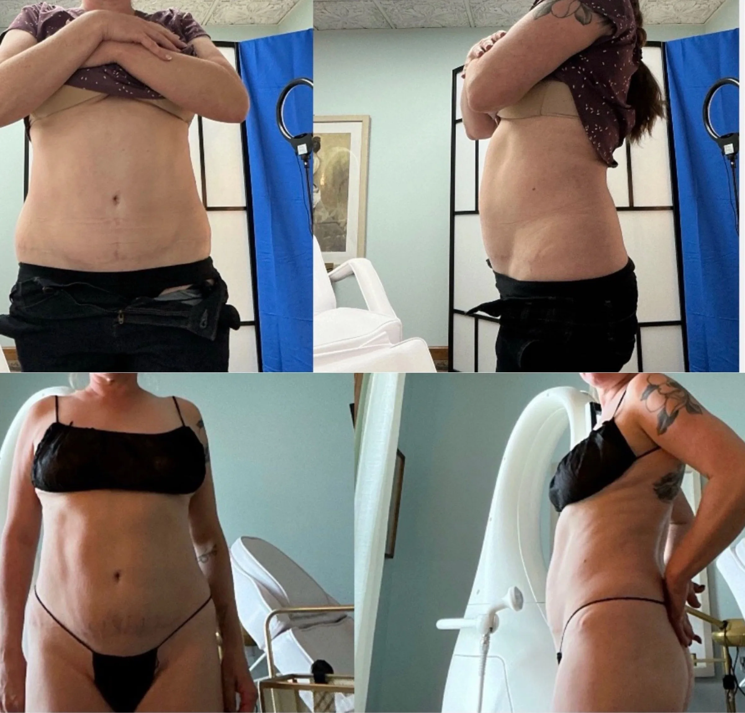 Best Med Spa for Body Contouring: 2026 Guide