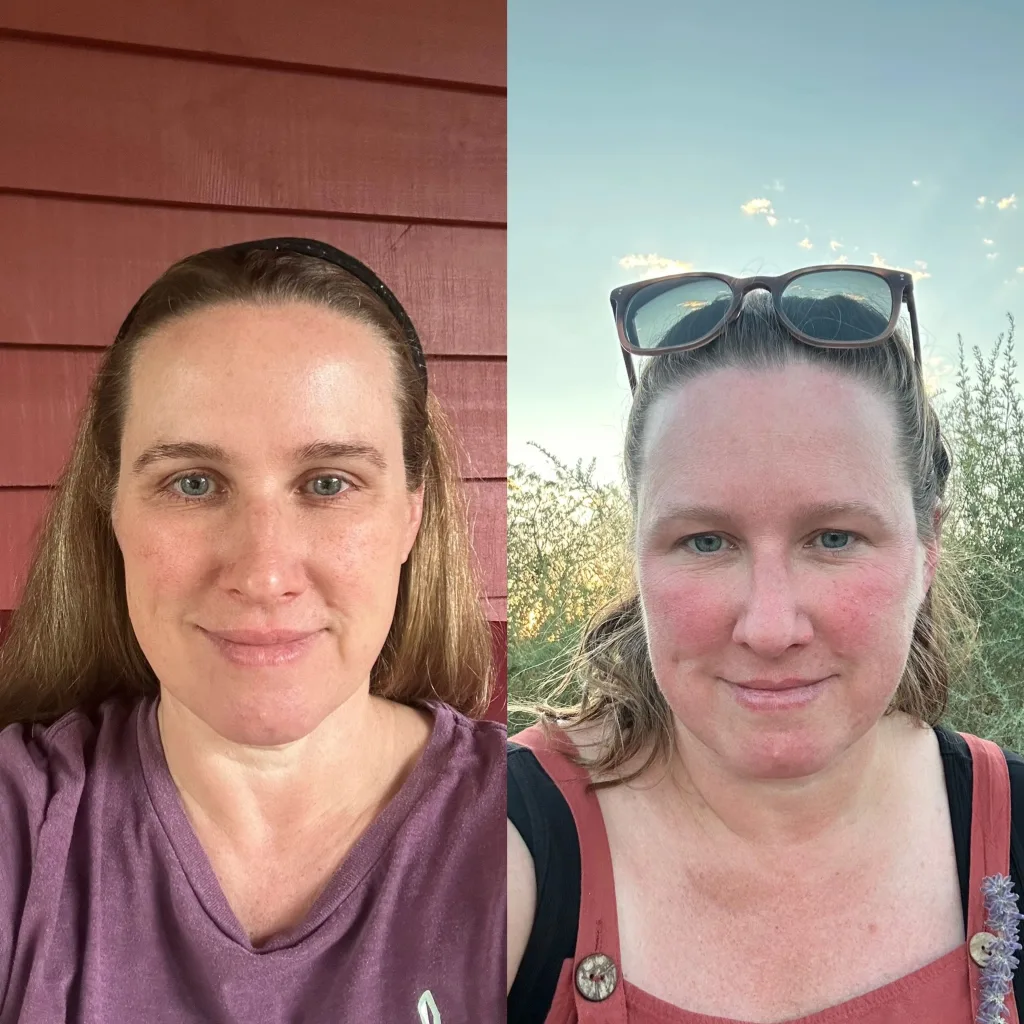 Two front photos of the same woman's face, side by side