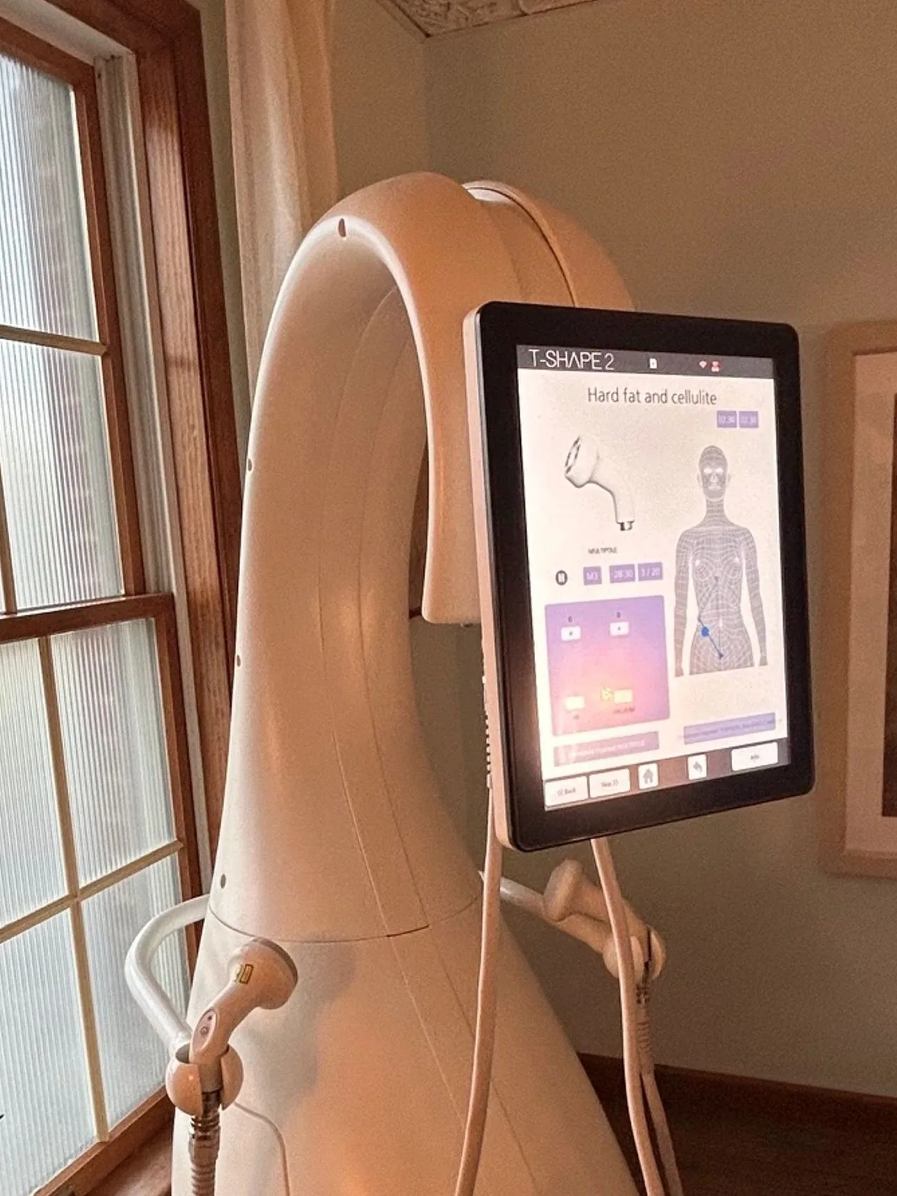 Tshape 2 machine with its touch screen, standing in a treatment room beside a window.