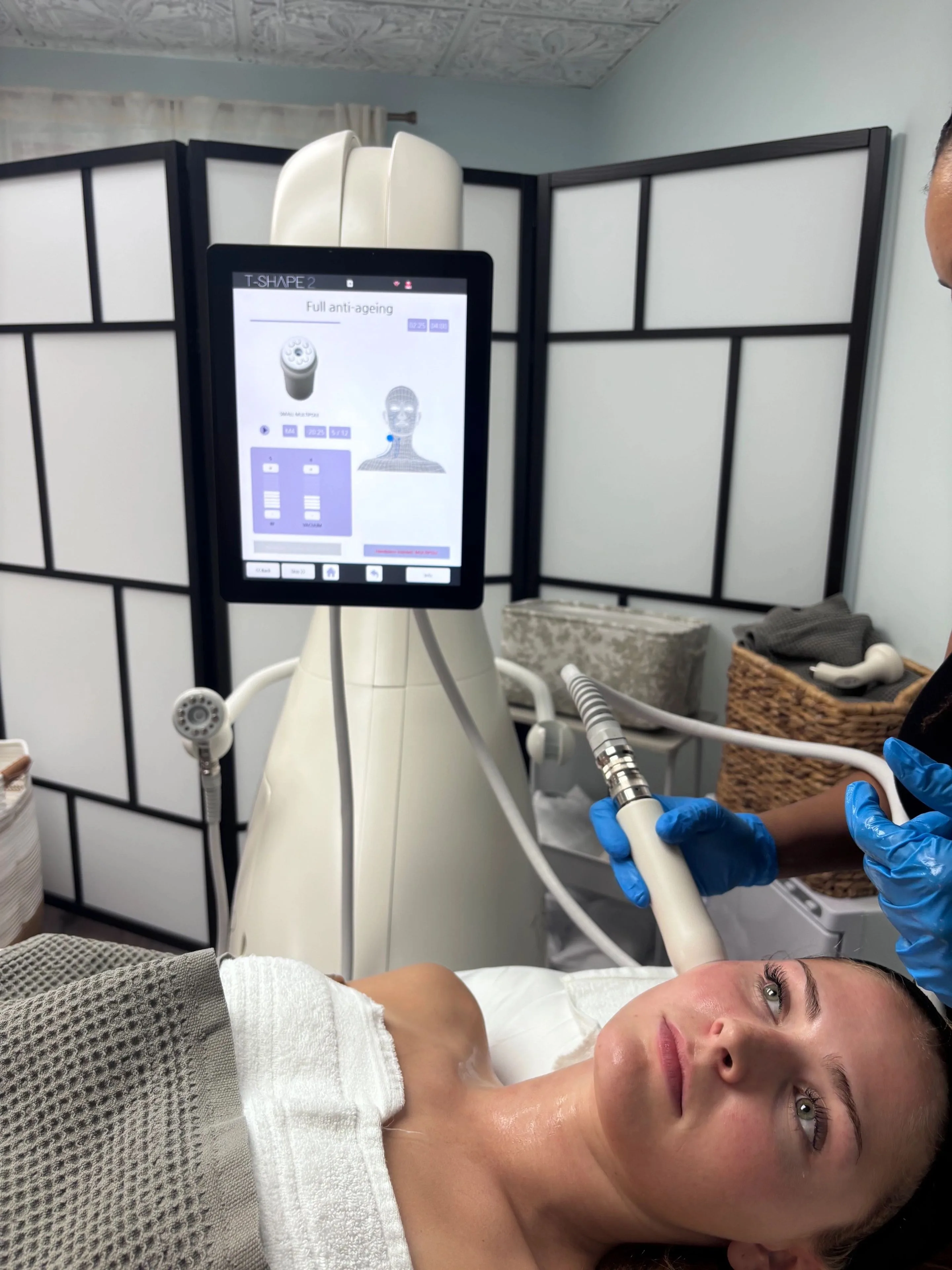 Gloved provider moving the Tshape 2 handpiece over a reclining client's cheek, with the machine screen behind